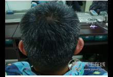 擔(dān)心白發(fā)一直冒出來(lái)？4大養(yǎng)發(fā)食物告訴你