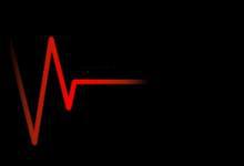 心跳每分鐘超過這個數 血管或可