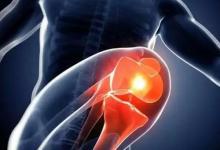 膝關節為什么會發出彈響？