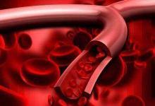 小心！血管都是被這幾個(gè)壞習(xí)慣毀掉的