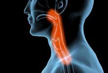 總是想清嗓子是怎么回事？ 保護嗓子有絕招