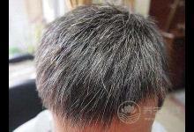 3種食物吃太多，白發、掉發就會找上門！