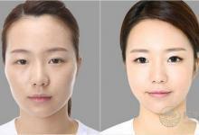 整容風水學 不可不知的整容禁忌