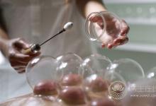 拔火罐的三大禁忌你知幾個?