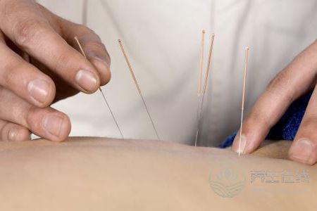 針灸減肥效果好不好呢 針灸減肥效果好不好呢