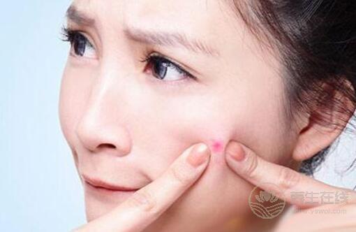 臉上長痘痘吃什么好？
