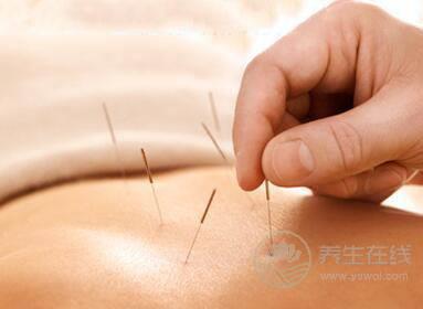 針灸減肥有效嗎針灸減肥有關的知識