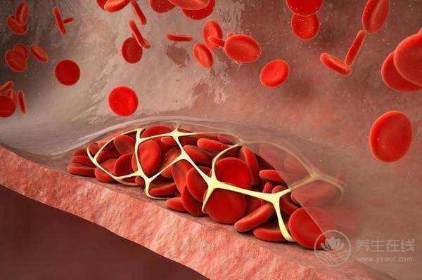 患高血脂人群越來越多,多吃這6種食物可以有效預防 患高血脂人群越來越多,多吃這6種食物可以有效預防