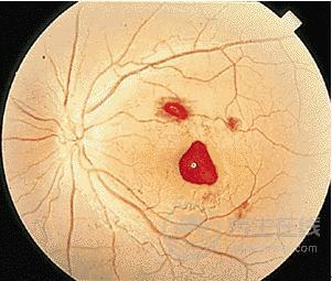 這兩類食物很毒，最容易導致肝癌，很多人還不注意