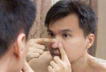 假期飲食不當竟會惹上皮膚??？節(jié)后調(diào)理身體需注意4點