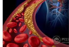 午飯后適合做什么？