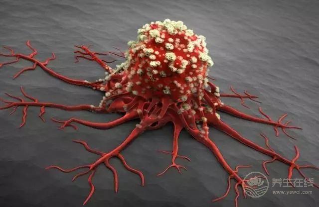 癌癥也會挑人，常吃這幾種食物不給癌癥有機可乘