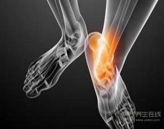 痛風病是不是不能吃這一物? 痛風病是不是不能吃這一物?