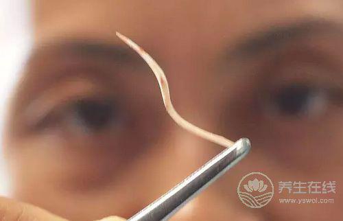  被魚刺卡了，吃飯團喝醋？錯！