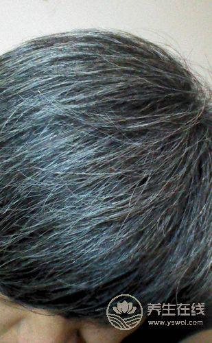 想要白發變黑發，需要做好5點