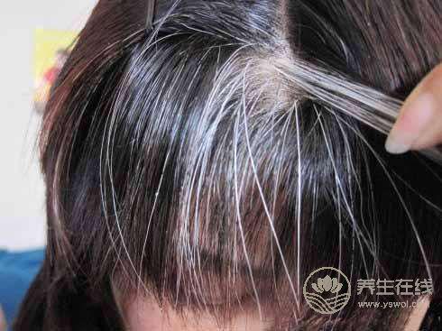 想要白發變黑發，需要做好5點