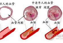 泡腳水加點姜，能有想不到的功效