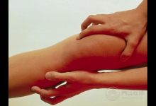 半夜小腿抽筋別以為是小事，真相往往令人驚呆了！