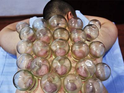 拔罐可以起到補腎的效果嗎 想要補腎應該吃什么