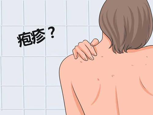 嘴上長皰疹怎么樣治療恢復的更快