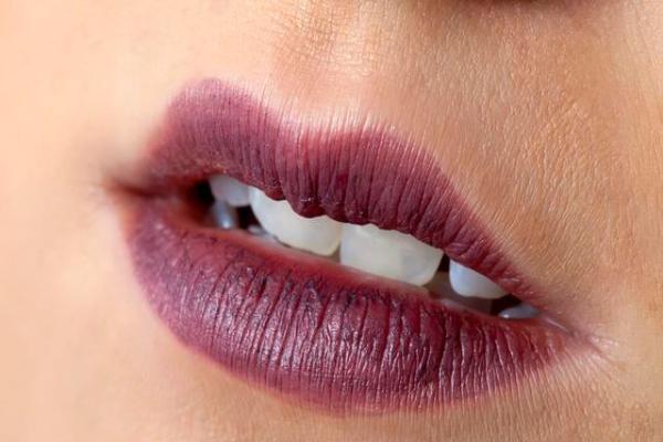 嘴唇被蚊子咬后發腫應該如何解決 嘴唇被蚊子咬后發腫應該如何解決