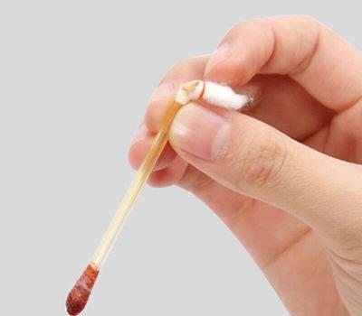 當(dāng)身體出現(xiàn)傷口可以用碘伏消毒嗎 當(dāng)身體出現(xiàn)傷口可以用碘伏消毒嗎