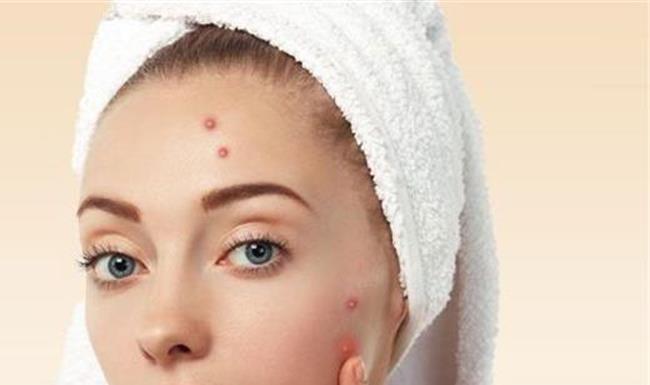 長痘痘在排完痘痘之后抹什么消炎 長痘痘在排完痘痘之后抹什么消炎