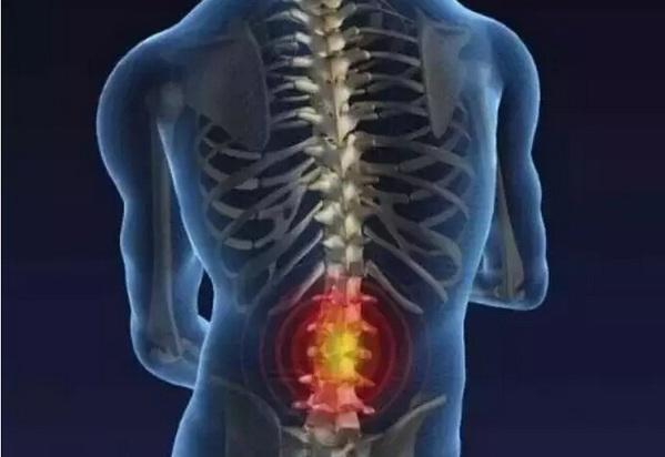 檢查腰椎是否健康要檢查哪些方面 檢查腰椎是否健康要檢查哪些方面