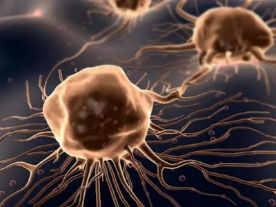 鼻子內部如果出現腫瘤會有哪些癥狀