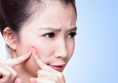 臉上長粉刺的原因為什么下巴處會起粉刺