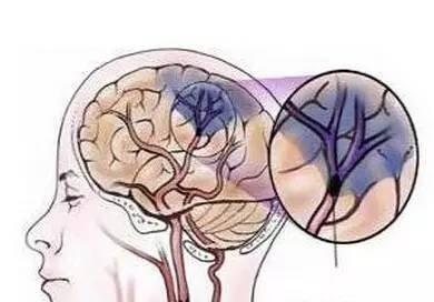 交感神經的作用抑制興奮的有效藥物