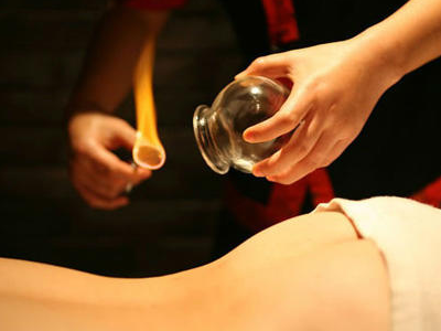 拔罐的時間保持在多長時間比較好