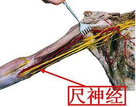 尺神經是什么一旦損傷需要怎樣康復