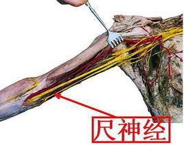 尺神經是什么一旦損傷需要怎樣康復