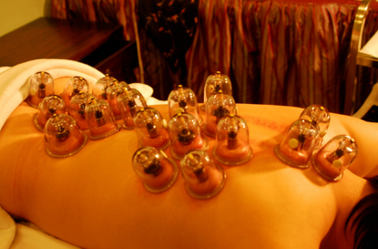 拔罐需要注意哪些方面又存在著哪些禁忌