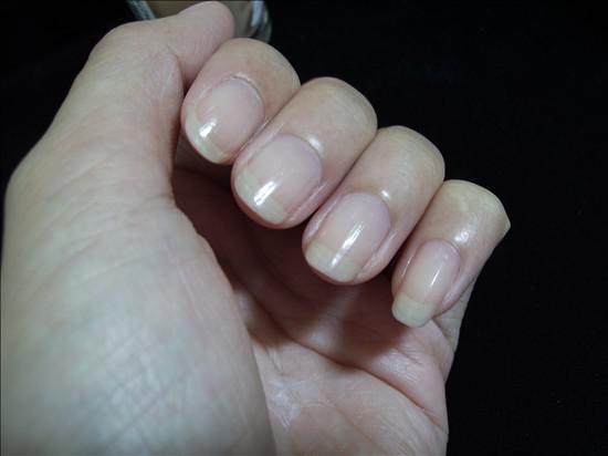 指甲的保護方法指甲豎著裂開的原因