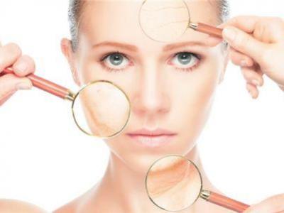 導致嘴唇周圍容易長痘的原因有哪些