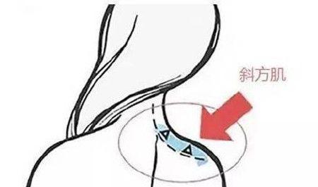 斜方肌可以通過(guò)按摩的方式消除嗎
