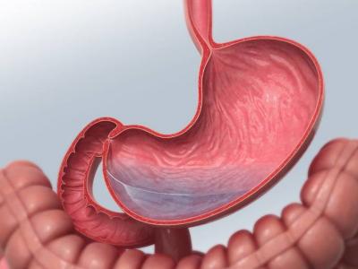 經常吃哪些食物容易導致腸胃中長石頭