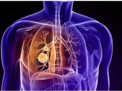 肺部功能的監(jiān)測分別監(jiān)測哪些方面