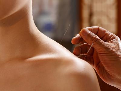 一天之內適合針灸的時間段是什么時候