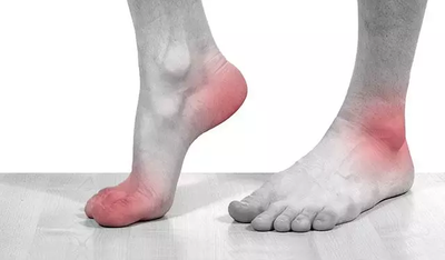 痛風患者是否可以適當的飲用白酒