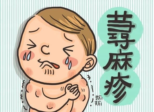 蕁麻疹有哪些治療效果比較好的方法