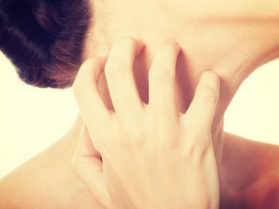 導致皮炎濕疹不停的反復發作的習慣