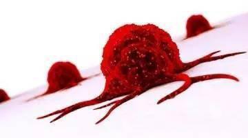 囊腫和腫瘤有什么區(qū)別囊腫會(huì)變成腫瘤嗎