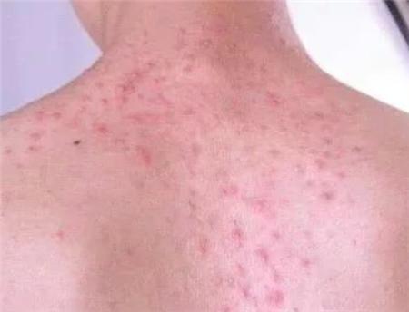 記住這四句話可以祛除體內的濕毒