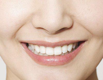 牙齦發炎的癥狀以及牙齦發炎的解決方法-易網健康<a href=http://m.henggaotouzi.com/jkys/ target=_blank class=infotextkey>養生</a>網 牙齦發炎的癥狀以及牙齦發炎的解決方法