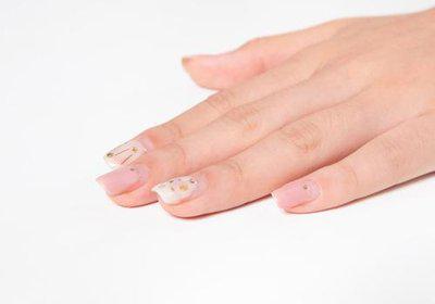 手指甲上突然出現豎紋是身體出問題了嗎