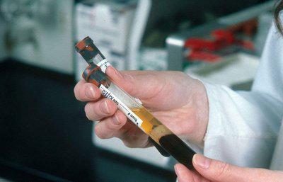 身體檢查性激素六項的標準值是多少-易網健康<a href=http://m.henggaotouzi.com/jkys/ target=_blank class=infotextkey>養生</a>網 身體檢查性激素六項的標準值是多少