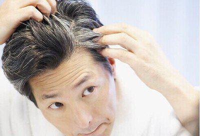 哪些食物可以讓白發變黑讓您重新擁有黑發